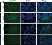 Fig.5.G showing Immunocytochemistry-immunofluorescence from the publication: Bifidobacterium pseudolongum-Derived Bile Acid from Dietary Carvacrol and Thymol Supplementation Attenuates Colitis via cGMP-PKG-mTORC1 Pathway.