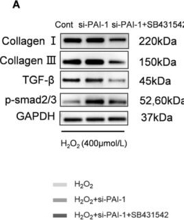 Fig.10.A showing Western Blotting from the publication: Plasminogen Activator Inhibitor 1 Controls Abdominal Aortic Aneurism Formation via the Modulation of TGF-β/Smad2/3 Signaling in Mice.