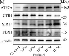 Fig.1.M showing Western Blotting from the publication: SIRT5 mediates the pro-osteogenic effects of estrogen through FDX1 demalonylation and cuproptosis inhibition in mesenchymal stem cells.