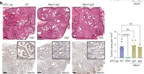 Fig.7.H showing Immunohistochemistry from the publication: ERG-driven prostate cancer initiation is cell-context dependent and requires KMT2A and DOT1L.