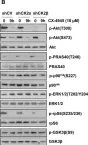 Fig.3.B showing Western Blotting from the publication: Effects of CK2β subunit down-regulation on Akt signalling in HK-2 renal cells.
