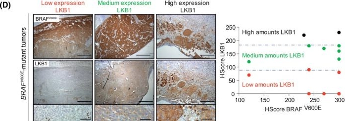 Fig.1.D showing Immunohistochemistry from the publication: Loss of Lkb1 cooperates with BrafV600E and ultraviolet radiation, increasing melanoma multiplicity and neural-like dedifferentiation.