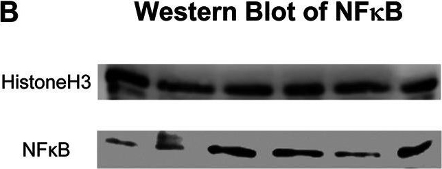 Fig.6.B showing Western Blotting in a Rattus norvegicus (Rat) sample from the publication: Improved Survival and Retinal Function of Aging ZDF Rats in Long-Term, Uncontrolled Diabetes by BGP-15 Treatment.