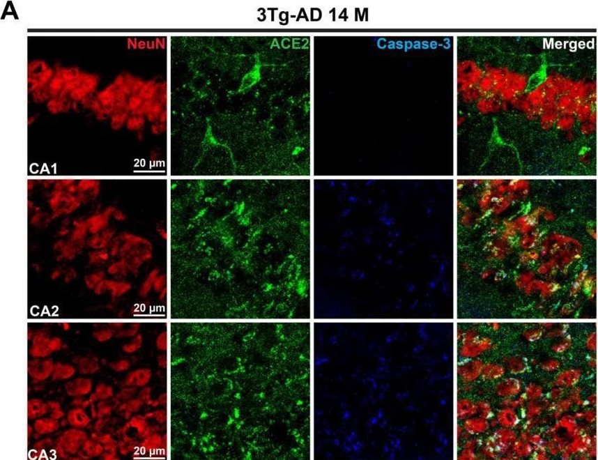 Fig.3.A showing Immunohistochemistry-immunofluorescence in a Mus musculus (House mouse) sample from the publication: Erebosis of Neurons May Exist in the Brain with Alzheimer's Disease.