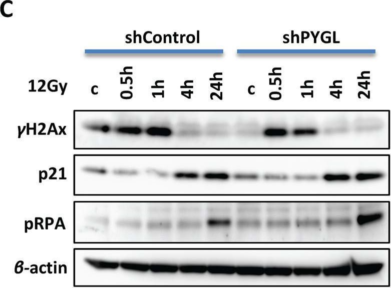 Fig.3.C showing Western Blotting from the publication: Liver glycogen phosphorylase is upregulated in glioblastoma and provides a metabolic vulnerability to high dose radiation.
