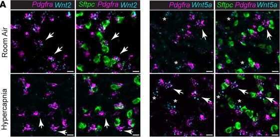 Fig.7.A showing Immunohistochemistry-immunofluorescence in a Mus musculus (House mouse) sample from the publication: Hypercapnia alters stroma-derived Wnt production to limit β-catenin signaling and proliferation in AT2 cells.