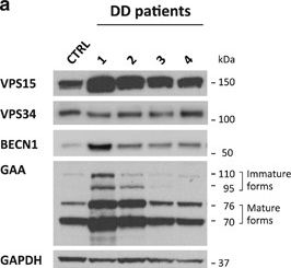 Fig.3.A showing Western Blotting in a Homo sapiens (Human) sample from the publication: Autophagy dysregulation in Danon disease.