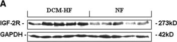 Fig.1.A showing Western Blotting in a Homo sapiens (Human) sample from the publication: Elevation of IGF-2 receptor and the possible underlying implications in end-stage heart failure patients before and after heart transplantation.