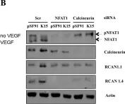 Fig.5.B showing Western Blotting from the publication: Kaposi's sarcoma herpesvirus K15 protein contributes to virus-induced angiogenesis by recruiting PLCγ1 and activating NFAT1-dependent RCAN1 expression.