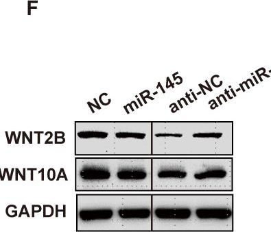 Fig.3.F showing Western Blotting from the publication: LincROR promotes tumor growth of colorectal cancer through the miR-145/WNT2B/WNT10A/Wnt/β-catenin regulatory axis.