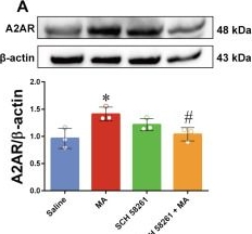 Fig.5.A showing Western Blotting from the publication: Adenosine A2A Receptor Contributes to Bidirectional Remodeling of Microglial Inflammatory Responses During Methamphetamine Exposure.