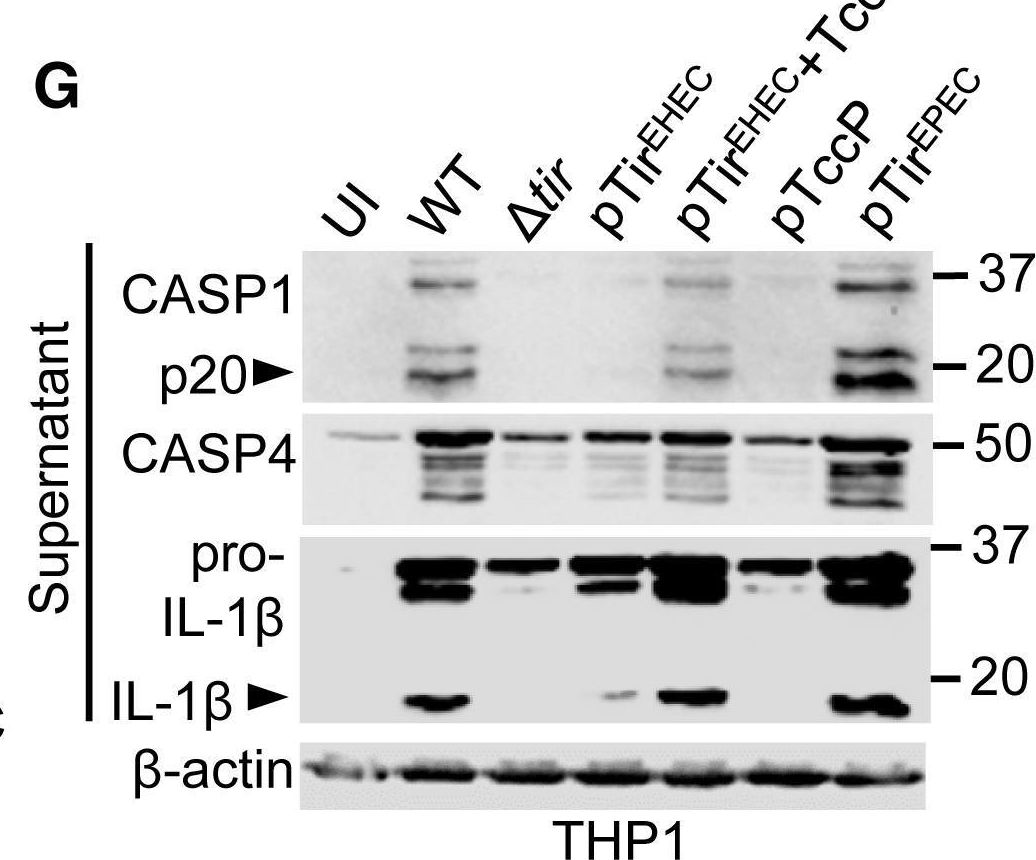 Fig.5.G showing Western Blotting in a Homo sapiens (Human) sample from the publication: Enteropathogenic Escherichia coli Stimulates Effector-Driven Rapid Caspase-4 Activation in Human Macrophages.