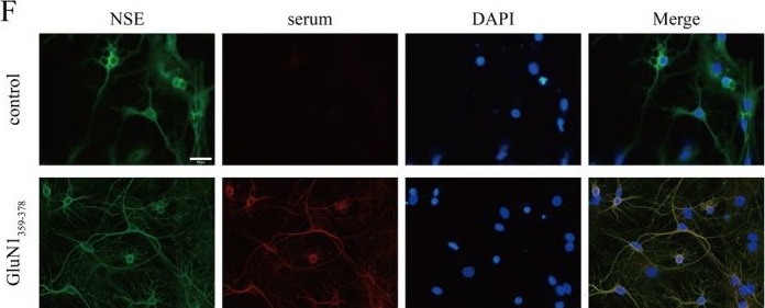 Fig.1.F showing Immunocytochemistry-immunofluorescence in a Mus musculus (House mouse) sample from the publication: Elevated Release of Presynaptic Glutamate: The Potential Pathogenesis of Anti-NMDAR Encephalitis-Associated Seizures.
