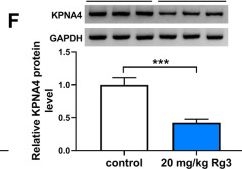 Fig.8.F showing Western Blotting from the publication: Ginsenoside Rg3 inhibits osteosarcoma progression by reducing circ_0003074 expression in a miR-516b-5p/KPNA4-dependent manner.