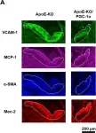 Fig.4.A showing Immunohistochemistry-frozen tissue in a Mus musculus (House mouse) sample from the publication: Skeletal Muscle-specific PGC-1α Overexpression Suppresses Atherosclerosis in Apolipoprotein E-Knockout Mice.