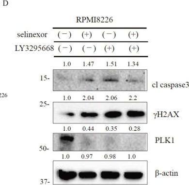 Fig.4.D showing Western Blotting in a Homo sapiens (Human) sample from the publication: Therapeutic Potential of Exportin 1 and Aurora Kinase A Inhibition in Multiple Myeloma Cells.