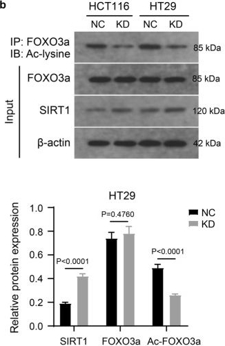 Fig.3.B showing Western Blotting from the publication: ZMIZ1 Regulates Proliferation, Autophagy and Apoptosis of Colon Cancer Cells by Mediating Ubiquitin-Proteasome Degradation of SIRT1.