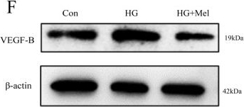 Fig.3.F showing Western Blotting from the publication: Melatonin attenuates diabetic cardiomyopathy by increasing autophagy of cardiomyocytes via regulation of VEGF-B/GRP78/PERK signaling pathway.