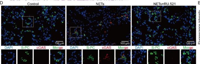 Fig.7.D showing Immunohistochemistry-immunofluorescence from the publication: Neutrophil extracellular traps trigger alveolar epithelial cell necroptosis through the cGAS-STING pathway during acute lung injury in mice.