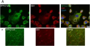 Fig.4.A showing Immunocytochemistry-immunofluorescence from the publication: BPAG1a and b associate with EB1 and EB3 and modulate vesicular transport, Golgi apparatus structure, and cell migration in C2.7 myoblasts.