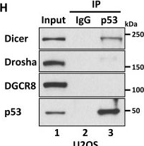 Fig.1.H showing Western Blotting in a Homo sapiens (Human) sample from the publication: An unexpected role for Dicer as a reader of the unacetylated DNA binding domain of p53 in transcriptional regulation.