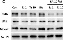 Fig.10.C showing Western Blotting from the publication: Synergistic antitumor activity by combining trastuzumab with retinoic acid in HER2 positive human breast cancer cells.