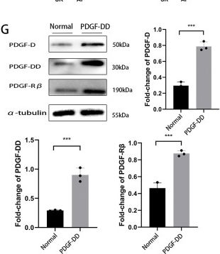 Fig.2.G showing Western Blotting in a Homo sapiens (Human) sample from the publication: miRNA101a secreted by EATMs regulates atrial fibrillation through the PDGF-mediated PI3K/AKT pathway.