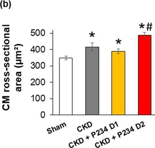 Fig.4.B from the publication: The kisspeptin-1 receptor antagonist peptide-234 aggravates uremic cardiomyopathy in a rat model.