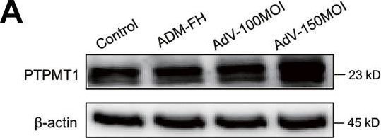 Fig.6.A showing Western Blotting from the publication: PTPMT1 protects cardiomyocytes from necroptosis induced by γ-ray irradiation through alleviating mitochondria injury.