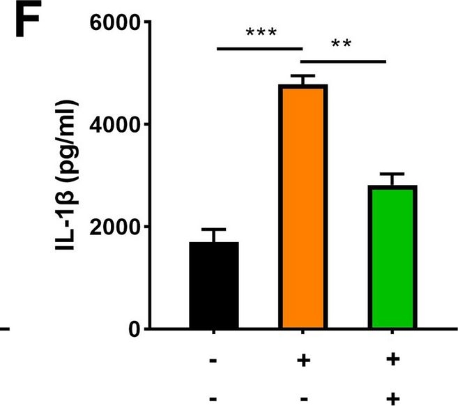 Fig.9.F showing Enzyme-linked immunosorbent assay from the publication: Microbiome dysbiosis in patients with chronic endometritis and Clostridium tyrobutyricum ameliorates chronic endometritis in mice.