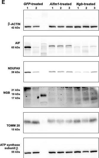 Fig.4.E showing Western Blotting in a Mus musculus (House mouse) sample from the publication: Neuroglobin overexpression in cerebellar neurons of Harlequin mice improves mitochondrial homeostasis and reduces ataxic behavior.
