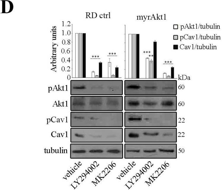 Fig.2.D showing Western Blotting in a Homo sapiens (Human) sample from the publication: Statin-Sensitive Akt1/Src/Caveolin-1 Signaling Enhances Oxidative Stress Resistance in Rhabdomyosarcoma.