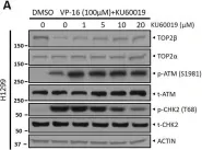Fig.2.A showing Western Blotting in a Homo sapiens (Human) sample from the publication: ATM inhibitor KU60019 synergistically sensitizes lung cancer cells to topoisomerase II poisons by multiple mechanisms.