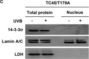 Fig.4.C showing Western Blotting in a Mus musculus (House mouse) sample from the publication: UVB-induced nuclear translocation of TC-PTP by AKT/14-3-3σ axis inhibits keratinocyte survival and proliferation.