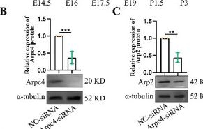 Fig.5.B showing Western Blotting from the publication: Microfilament-Myosin II Regulates the Differentiation of Multinucleated Cysts into Oocytes and Influences Oocyte Developmental Potential in Mice.