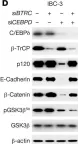 Fig.2.D showing Western Blotting from the publication: Stabilization of E-cadherin adhesions by COX-2/GSK3β signaling is a targetable pathway in metastatic breast cancer.