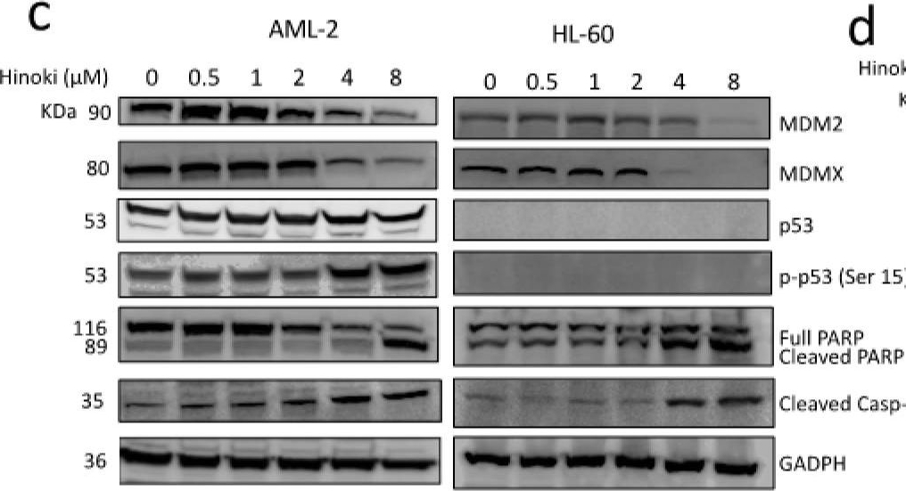 Fig.4.C showing Western Blotting in a Homo sapiens (Human) sample from the publication: Hinokiflavone Inhibits MDM2 Activity by Targeting the MDM2-MDMX RING Domain.