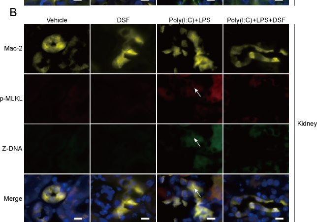 Fig.9.B showing Immunocytochemistry-immunofluorescence in a Mus musculus (House mouse) sample from the publication: Anti-alcoholism drug disulfiram inhibits PANoptosis by blocking mitochondrial permeabilization in macrophages.