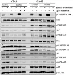 Fig.4.D showing Western Blotting in a Homo sapiens (Human) sample from the publication: Sustained activation of the AKT/mTOR and MAP kinase pathways mediate resistance to the Src inhibitor, dasatinib, in thyroid cancer.