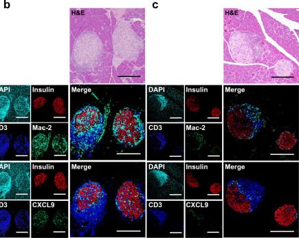 Fig.3.B showing Immunocytochemistry-immunofluorescence in a Mus musculus (House mouse) sample from the publication: Human adipose-derived mesenchymal stem cells prevent type 1 diabetes induced by immune checkpoint blockade.