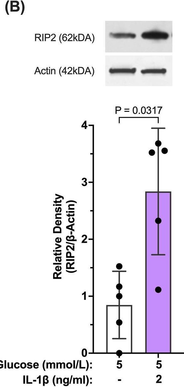 Fig.4.B showing Western Blotting from the publication: Interleukin-1 receptor-dependent and -independent caspase-1 activity in retinal cells mediated by receptor interacting protein 2.