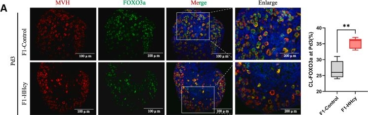 Fig.6.A showing Immunohistochemistry-immunofluorescence from the publication: Maternal hyperhomocysteinemia compromises female offspring fertility through overactivation of primordial follicles.