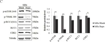 Fig.6.C showing Western Blotting from the publication: Phosphorylation of RCC1 on Serine 11 Facilitates G1/S Transition in HPV E7-Expressing Cells.