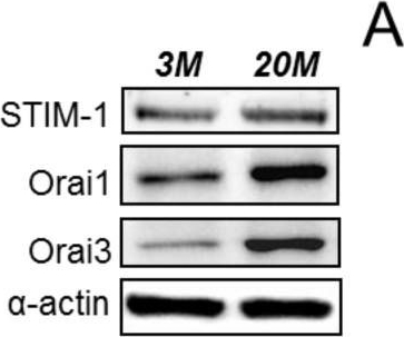 Fig.5.A showing Western Blotting in a Rattus norvegicus (Rat) sample from the publication: Upregulation of Orai Channels Contributes to Aging-Related Vascular Alterations in Rat Coronary Arteries.