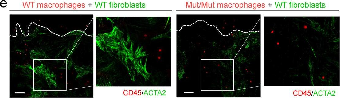 Fig.3.E showing Immunohistochemistry-immunofluorescence in a Mus musculus (House mouse) sample from the publication: The E3 ubiquitin ligase WWP2 regulates pro-fibrogenic monocyte infiltration and activity in heart fibrosis.