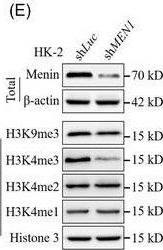 Fig.5.E showing Western Blotting from the publication: Loss of MEN1 leads to renal fibrosis and decreases HGF-Adamts5 pathway activity via an epigenetic mechanism.