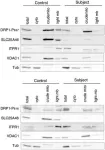 Fig.2.A showing Western Blotting in a Homo sapiens (Human) sample from the publication: SLC25A46 is required for mitochondrial lipid homeostasis and cristae maintenance and is responsible for Leigh syndrome.