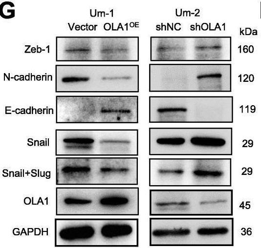 Fig.3.G showing Western Blotting from the publication: Obg-like ATPase 1 inhibited oral carcinoma cell metastasis through TGFβ/SMAD2 axis in vitro.