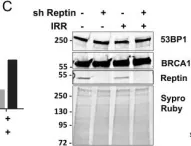 Fig.2.C showing Western Blotting in a Homo sapiens (Human) sample from the publication: Reptin regulates DNA double strand breaks repair in human hepatocellular carcinoma.
