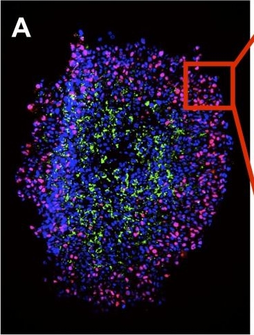 Inferring Growth Control Mechanisms in Growing Multi-cellular Spheroids of NSCLC Cells from Spatial-Temporal Image Data.